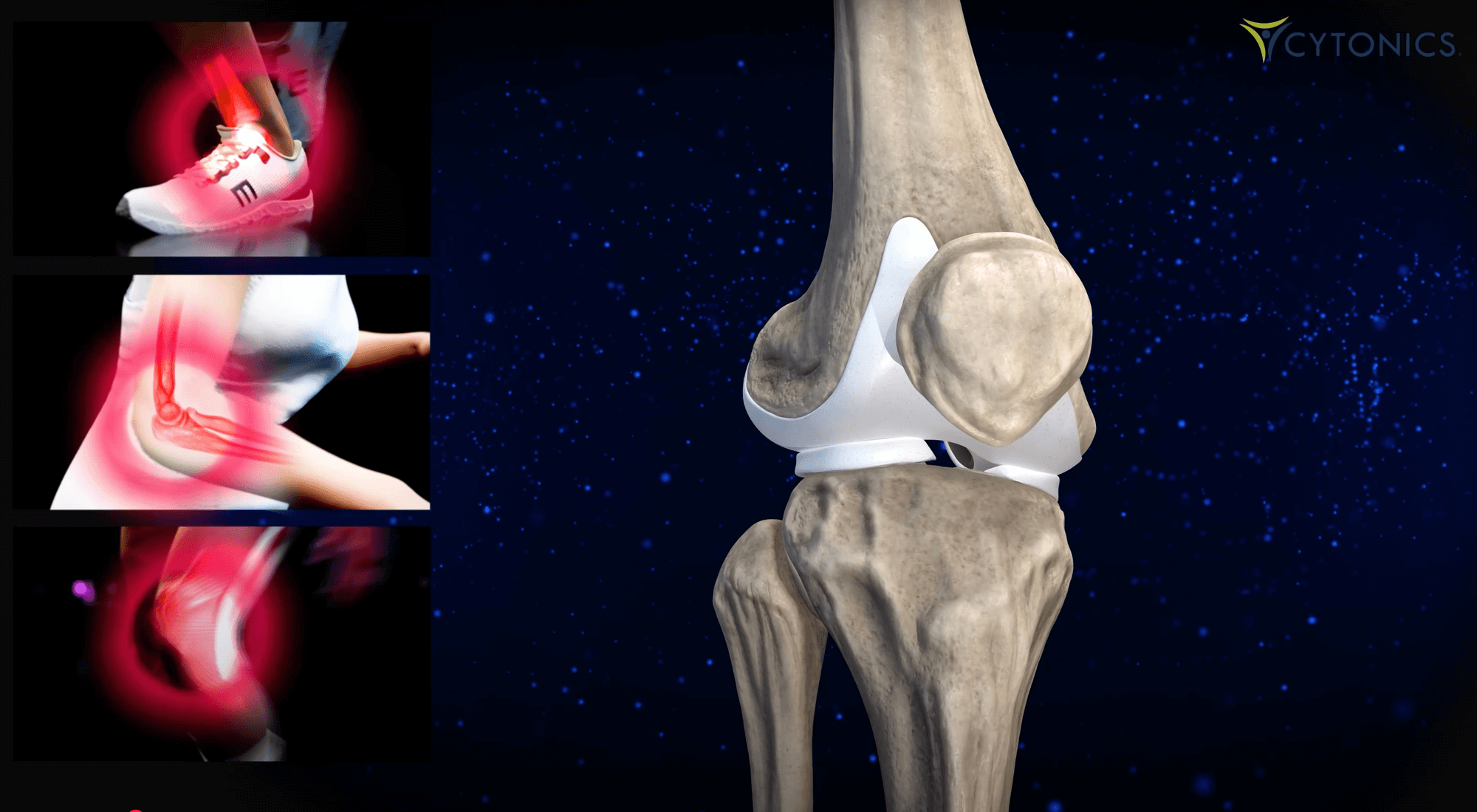 Could We Supercharge That Protein to Work Even Better?